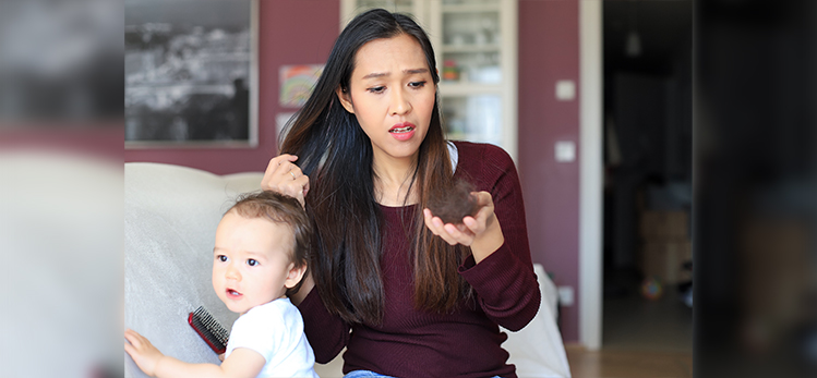 mother-hair-loss-postpartumyoung-asian
