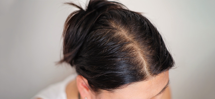 bald-man-woman-worry-about-his