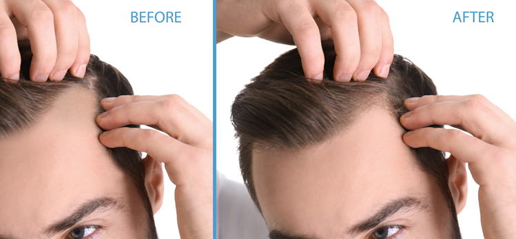 closeup-view-man-before-after