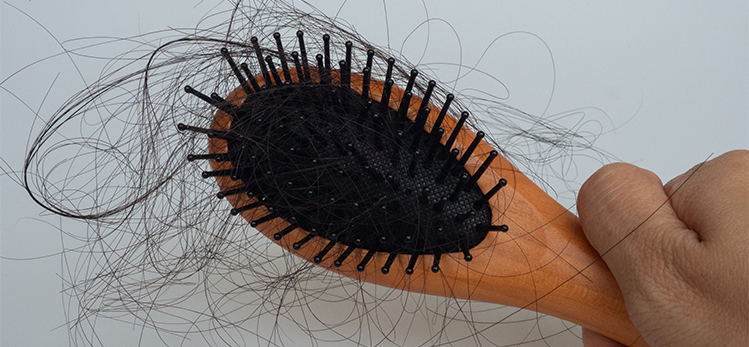 hair-falling-out-on-brush