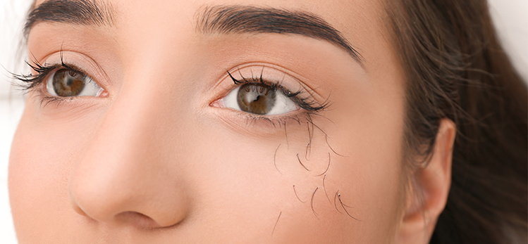 young-woman-eyelash-loss-problem