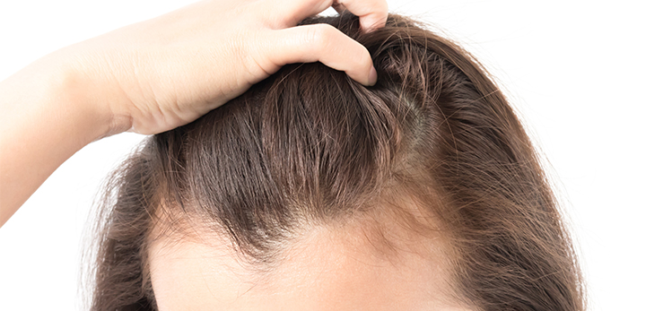 woman-serious-hair-loss-problem-health