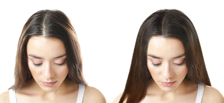 beautiful-young-woman-before-after-procedure