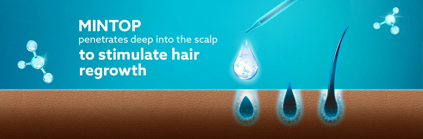 Minoxidil helps simulate hair growth