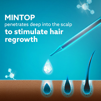 Minoxidil helps simulate hair growth