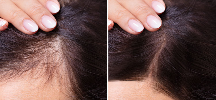 Girl showing her hair before and after of the treatment